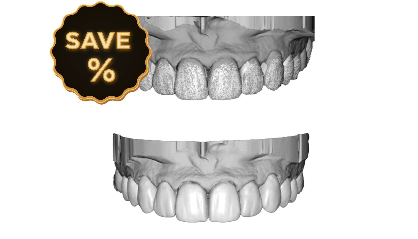 POST CASE ACCEPTANCE DESIGN PRODUCTS DSD Natural Restorations Design PER UNIT