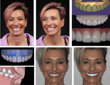 DR CHAD KASPEROWSKI DSD NR CASE STUDY PATIENT IMAGES 16