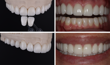 DR CHAD KASPEROWSKI DSD NR CASE STUDY PATIENT IMAGES 17