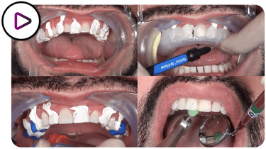 DSD DIRECT VIDEO TUTORIAL min