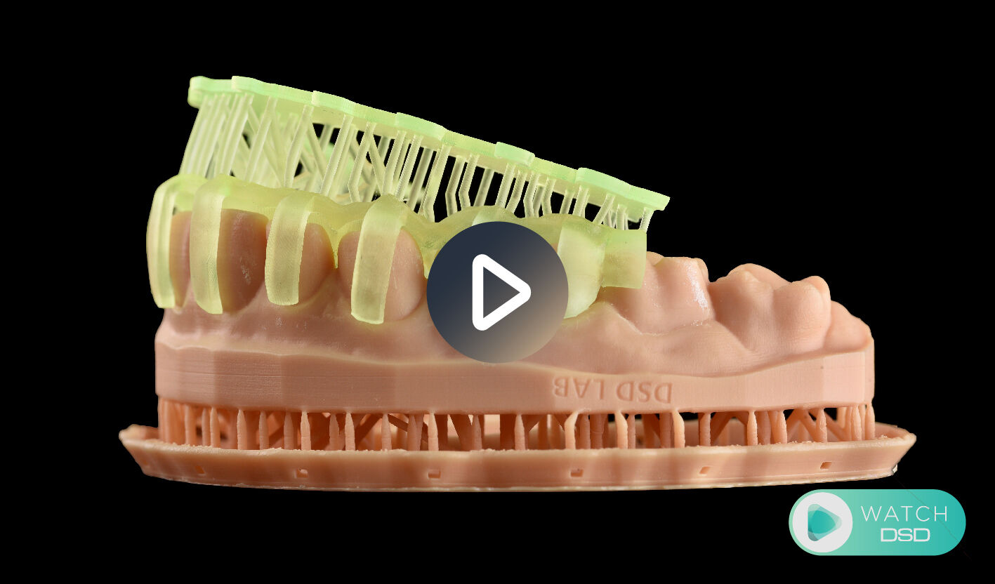 WHAT IS COMPREHENSIVE DIGITAL CARE Straightforward precision with Guided Dentistry V2