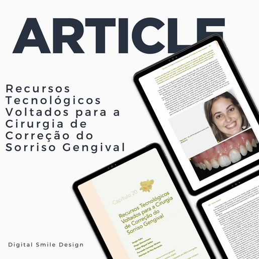 SQUARE thumbnail Recursos Tecnológicos Voltados para a Cirurgia de Correção do Sorriso Gengival