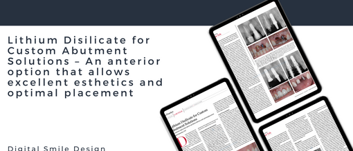 Lithium Disilicate for Custom Abutment Solutions An anterior option that allows excellent esthetics and optimal placement