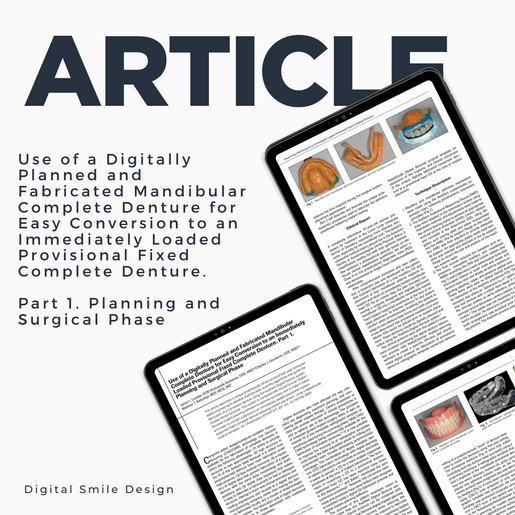 SQUARE thumbnail Use of a Digitally Planned and Fabricated Mandibular Complete Denture for Easy Conversion