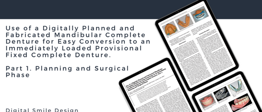 Use of a Digitally Planned and Fabricated Mandibular Complete Denture for Easy Conversion