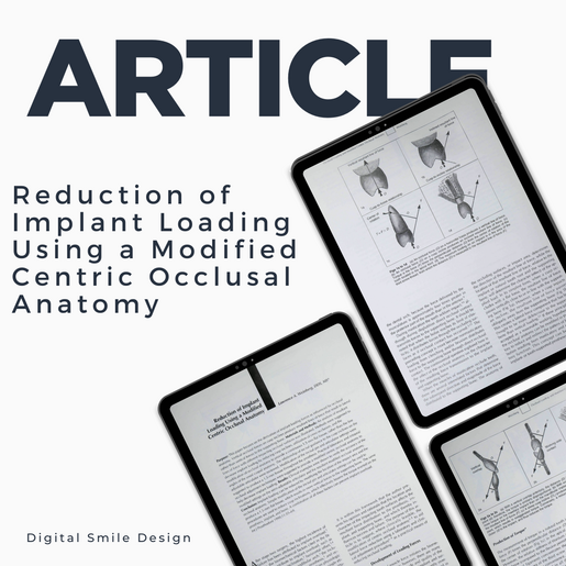 SQUARE thumbnail Reduction of Implant Loading Using a Modified Centric Occlusal Anatomy