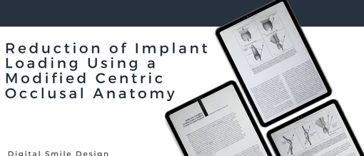 Reduction of Implant Loading Using a Modified Centric Occlusal Anatomy