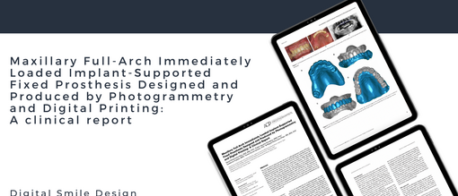 Maxillary full arch immediately loaded implant supported fixed prosthesis designed and produced by photogrammetry and digital printing