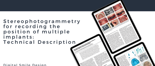 Stereophotogrammetry for recording the position of multiple implants technical description 1