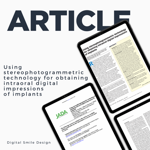 SQUARE thumbnail Using stereophotogrammetric technology for obtaining intraoral digital impressions of implants