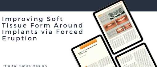 Improving Soft Tissue Form Around Implants via Forced Eruption