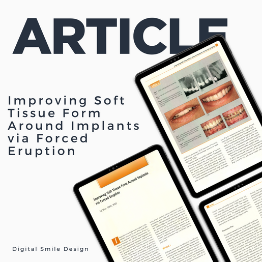 SQUARE thumbnail I Improving Soft Tissue Form Around Implants via Forced Eruption