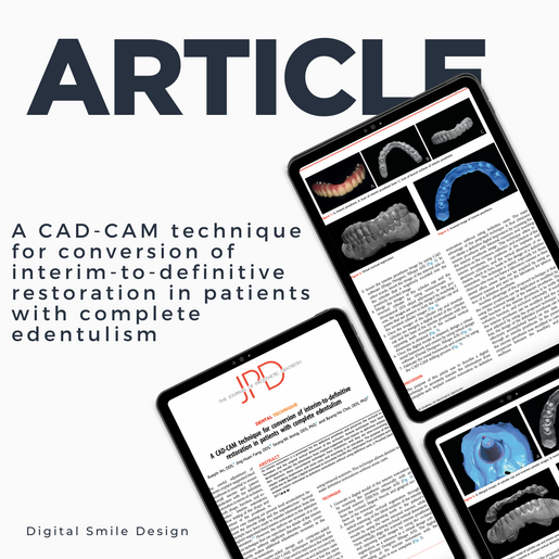 SQUARE thumbnail A CAD CAM technique for conversion of interim to definitive restoration in patients with complete edentulism