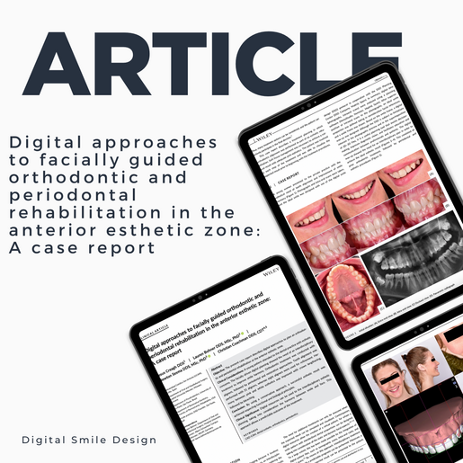 SQUARE thumbnail Digital approaches to facially guided orthodontic and periodontal rehabilitation in the anterior esthetic zone A case report