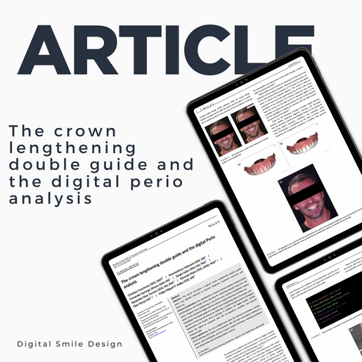 SQUARE thumbnail The crown lengthening double guide and the digital Perio analysis