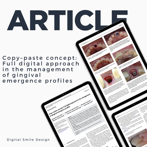 SQUARE thumbnail Copy paste concept Full digital approach in the management of gingival emergence profiles