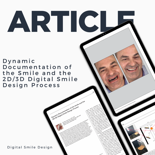 SQUARE thumbnail Dynamic Documentation of the Smile and the 2 D3 D Digital Smile Design Process