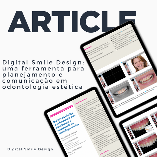 SQUARE thumbnail Digital smile design uma ferramenta para planejamento e comunicação em odontologia estética