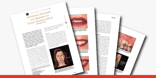 Differential Diagnosis and Treatment of Excess Gingival Display