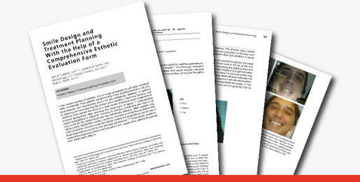 Smile design and treatment planning with the help of comprehensive esthetic evaluation form Calamia 2011