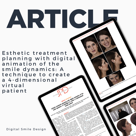 SQUARE thumbnail Esthetic treatment planning with digital animation of the smile dynamics A technique to create a 4 dimensional virtual patient