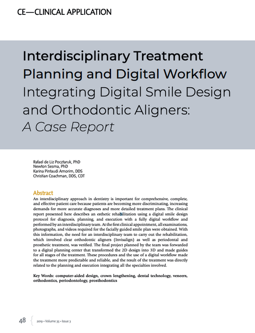 Interdisciplinary Treatment Planning and Digital Workflow Integrating Digital Smile Design and Orthodontic Aligners A Case Report