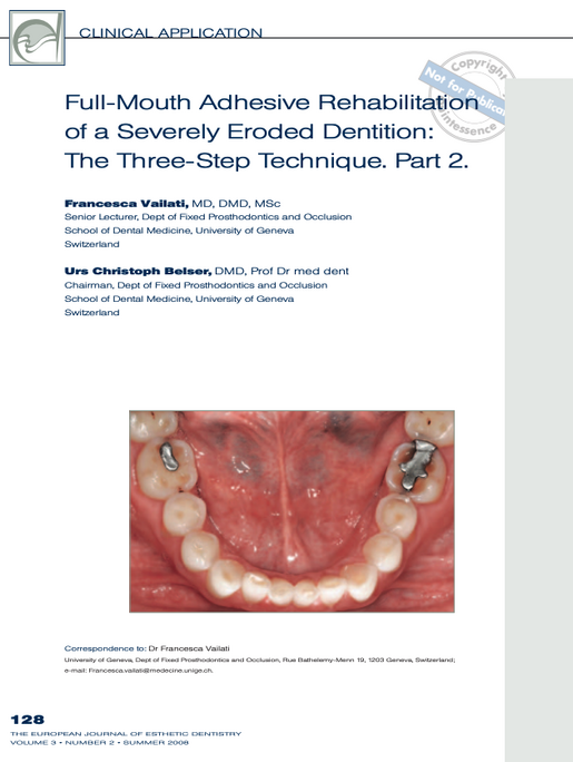 Full mouth adhesive rehabilitation of a severely eroded dentition the three step technique part 2