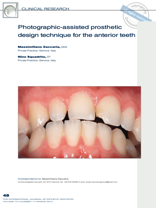Photographic assisted prosthetic design technique for the anetrion teeth
