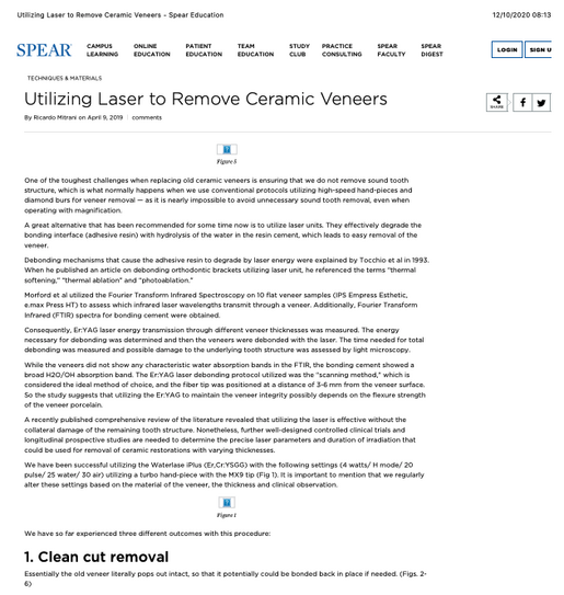 Utilizing Laser to Remove Ceramic Veneers
