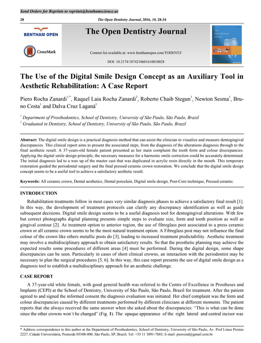 The Use of the Digital Smile Design Concept as an Auxiliary Tool in Aesthetic Rehabilitation