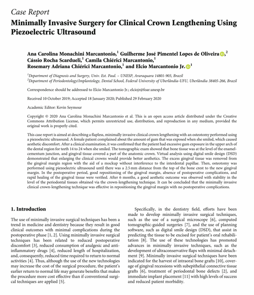 Minimally Invasive Surgery for Clinical Crown Lengthening Using Piezoelectric Ultrasound