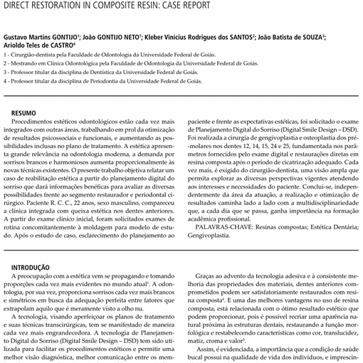 HARMONIZAÇ Ã O DO SORRISO POR MEIO DE CIRURGIA PERIODONTAL E RESTAURAÇ Õ ES DIRETAS
