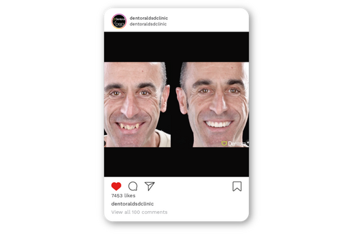 Instagram posts mock ups learning hub article 02
