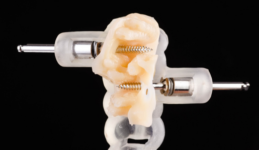 How can the DSD TAD Guide transform your ortho cases?