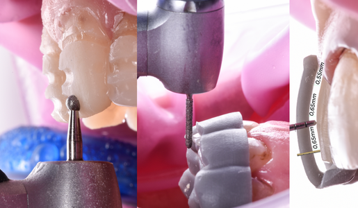 LEARNING HUB ARTICLES IMAGE Over prepping vs under prepping