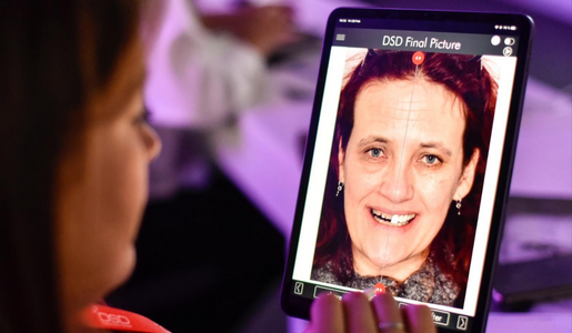 Simulate smiles easily with the DSD App