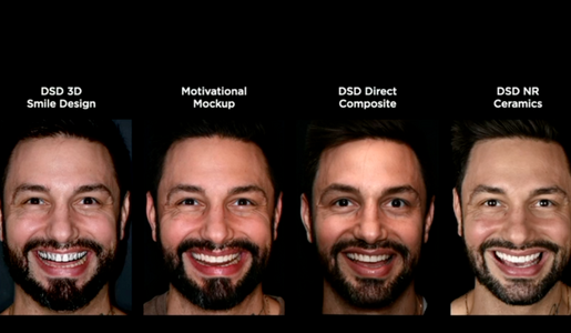 INTERDISCIPLINARY GUIDED DENTISTRY DIGITAL QUALITY CONTROL AND THE COPY PASTE CONCEPTS LEARNING HUB ARTICLE IMAGE