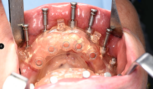 DSD CLINIC VS DENTAL CLINIC CLIC GUIDE LEARNING HUB ARTICLE IMAGE