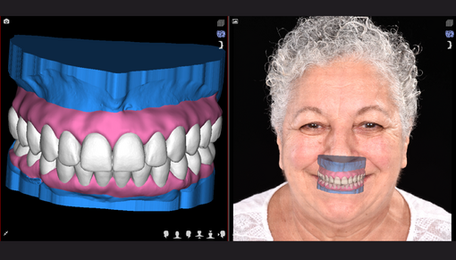 TREATMENT PLANNING VS PROCEDURE PLANNING LEARNING HUB THUMBNAIL IMAGE