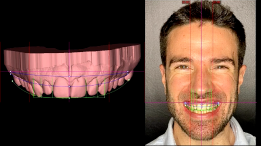 SMILE ARCHITECT AND DSD PLANNING SERVICES LEARNING HUB THUMBNAIL IMAGE