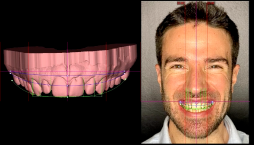 SMILE ARCHITECT AND DSD PLANNING SERVICES LEARNING HUB THUMBNAIL IMAGE