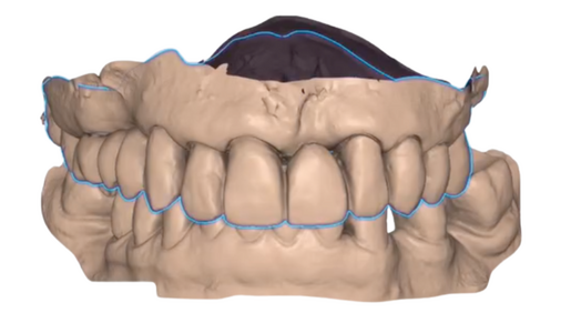 INTRAORAL SCANNER TIPS SCAN LEARNING HUB ARTICLE IMAGE