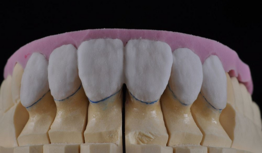 HANDLAYERED RESTORATIONS LEARNING HUB ARTICLE IMAGE