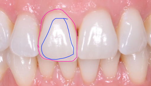 REAL VS PERCEIVED SHAPES LEARNING HUB THUMBNAIL IMAGE