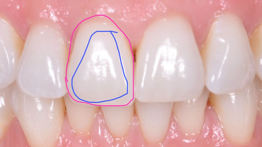 REAL VS PERCEIVED SHAPES LEARNING HUB THUMBNAIL IMAGE