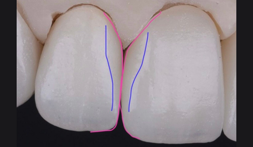 REAL VS PERCEIVED SHAPES LINE ANGLES LEARNING HUB ARTICLE IMAGE