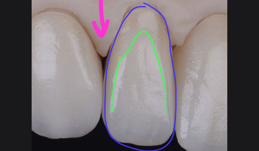 REAL VS PERCEIVED SHAPES LATERAL LEARNING HUB ARTICLE IMAGE