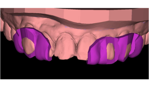 WHAT ARE PREP GUIDES REDUCTION GUIDE 2 LEARNING HUB ARTICLE IMAGE