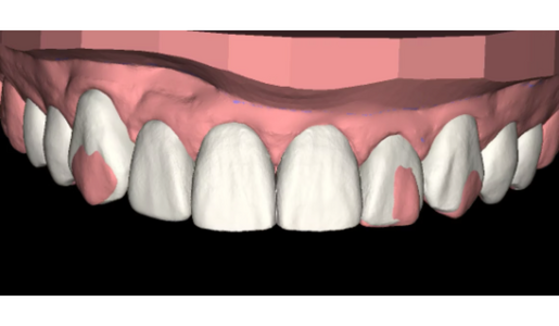 WHAT ARE PREP GUIDES REDUCTION GUIDE LEARNING HUB ARTICLE IMAGE