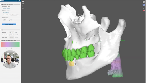 DSD ORTHO PLANNING VS TPS LEARNING HUB THUMBNAIL IMAGE